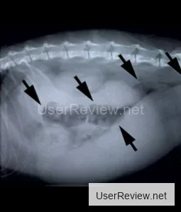 Vacuum Aspiration Method